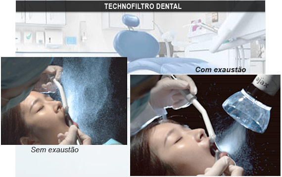 Technofiltro Dental
